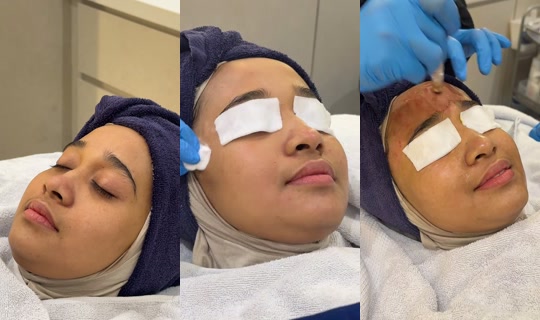 ainaabeautyofficial TikTok Live — Oct 8, 2026, 7:44 AM